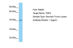 TWF2 Antibody, Novus Biologicals 100 &mu;L; Unconjugated:Antibodies, Polyclonal